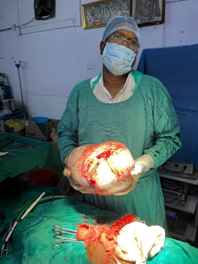 Dr. Anil Kumar performed a rare surgery at Rahul Hospital to remove a 15 kg tumor from his stomach