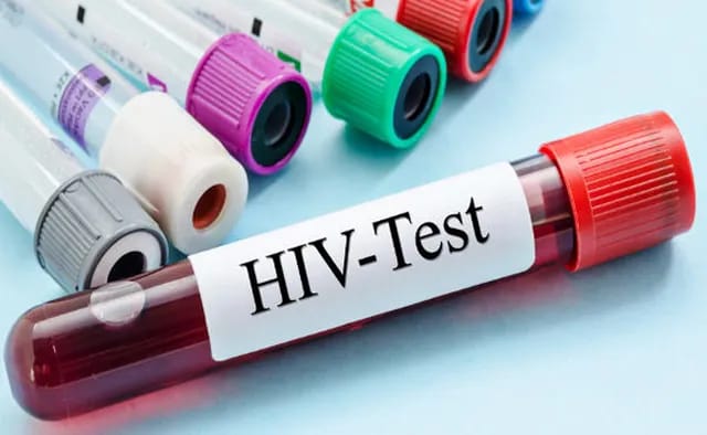 Tihar Jail : తిహార్‌ జైలులో 125 మంది ఖైదీలకు HIV