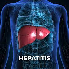 Hepatitis : హెపటైటిస్: ఈ వ్యాధి ఎందుకు వస్తుంది, ఎంత ప్రమాదం, ఎలా రక్షించుకోవాలో మీ కోసం