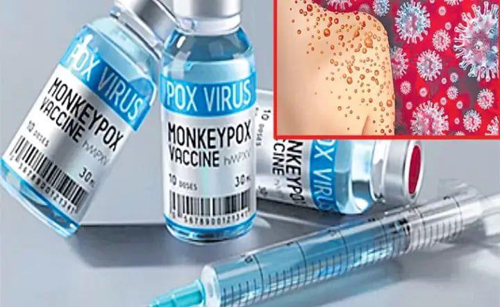 Monkeypox Virus : మరో మహమ్మారిఇప్పటికే ఆఫ్రికా దేశాలను చుట్టేసిన ప్రమాదకర మంకీపాక్స్‌ వైరస్‌