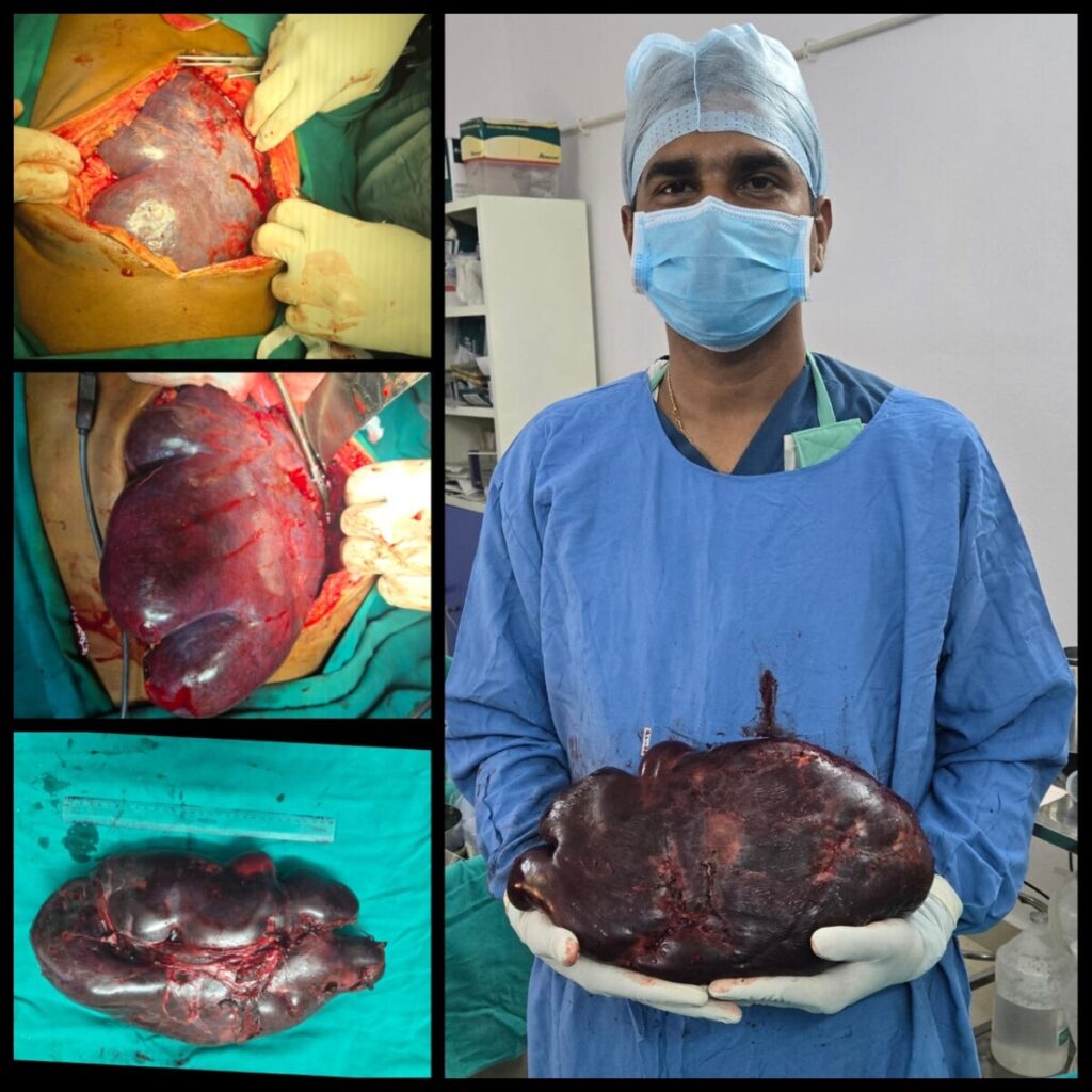 Rare operation in Srikakulam