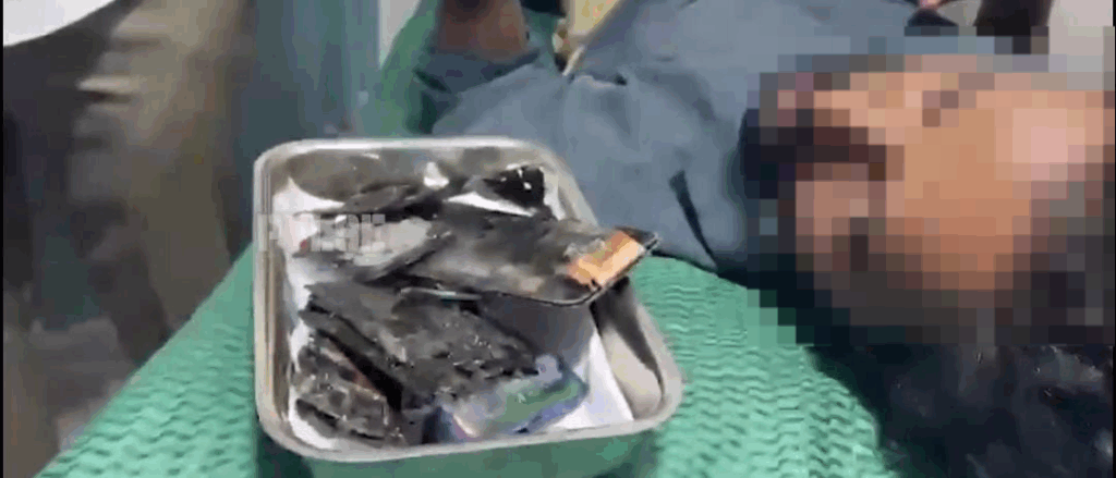 Exploding phone.. Young man 