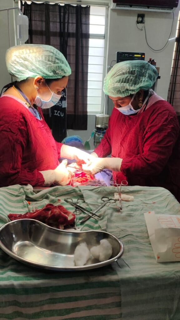 Successfully Conducted Laproscopic Surgery 