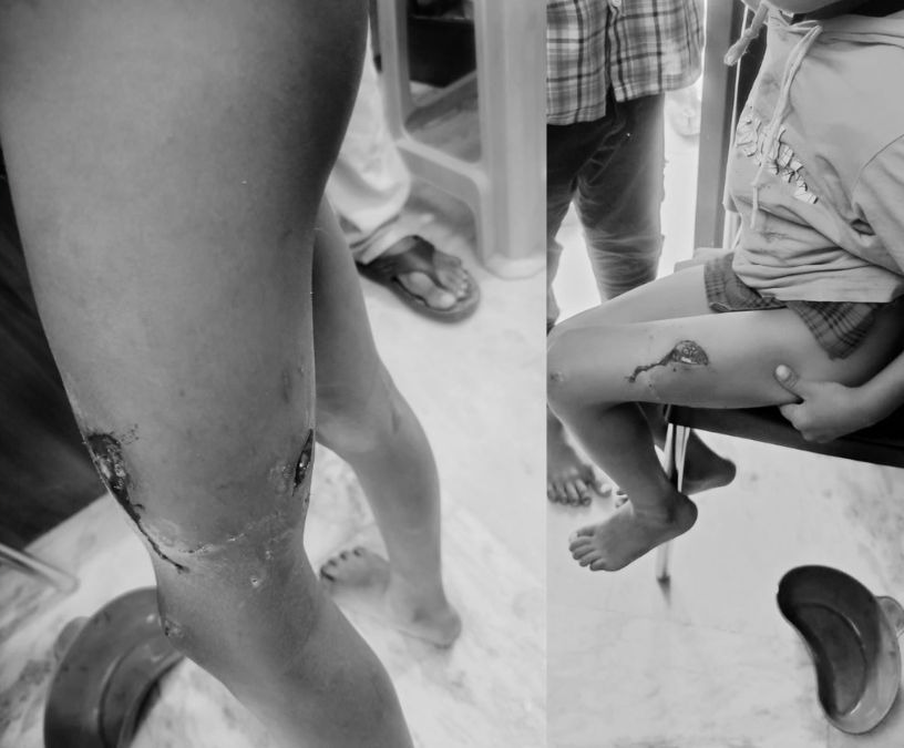 Atrocious in Hyderabad government school