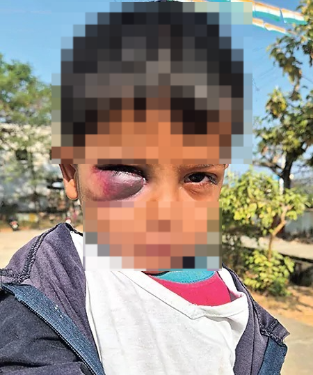 Anganwadi teacher beats boy to death