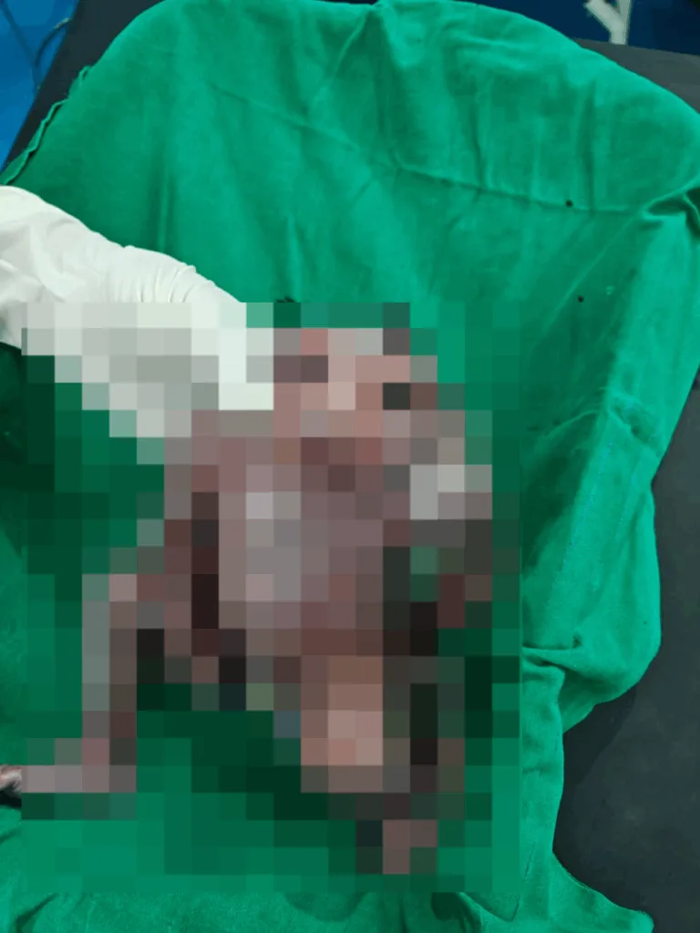 Rare baby born at Chintur 