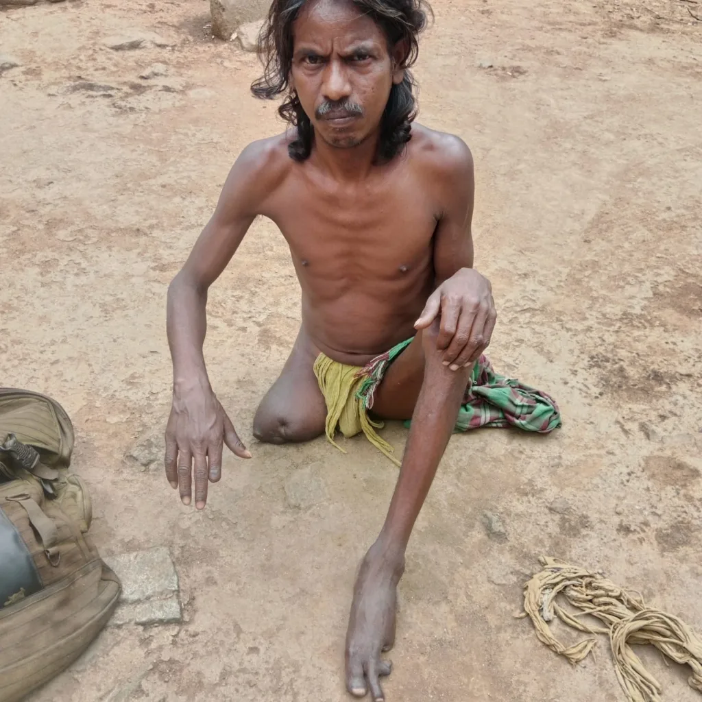 disability pension