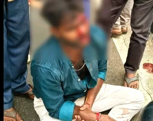 Accident : వివాహానికి వెళ్తుండగా ప్రమాదం, ఇద్దరికీ స్వల్ప గాయాలు. WhatsApp Image 2026-08-30 at 18.27.57